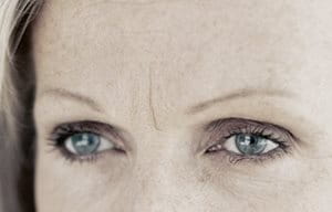 Beneficios del ácido hialurónico. eucerin sc ageing skin wrinkles 03 - Beneficios del ácido hialurónico.