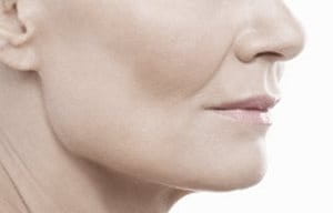 Beneficios del ácido hialurónico. eucerin sc ageing skin wrinkles 04 - Beneficios del ácido hialurónico.