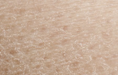 Суха шкіра крупним планом